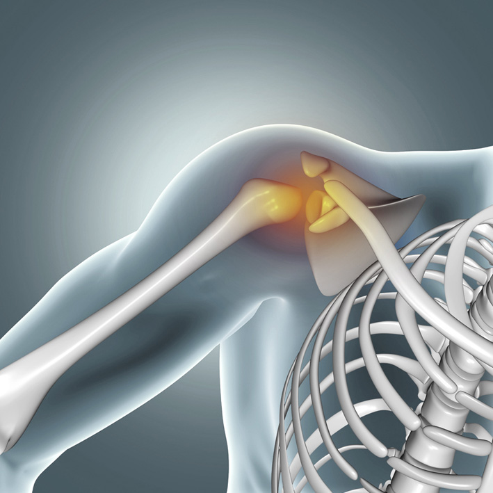 orthopedic surgery, Joint Replacement hospital